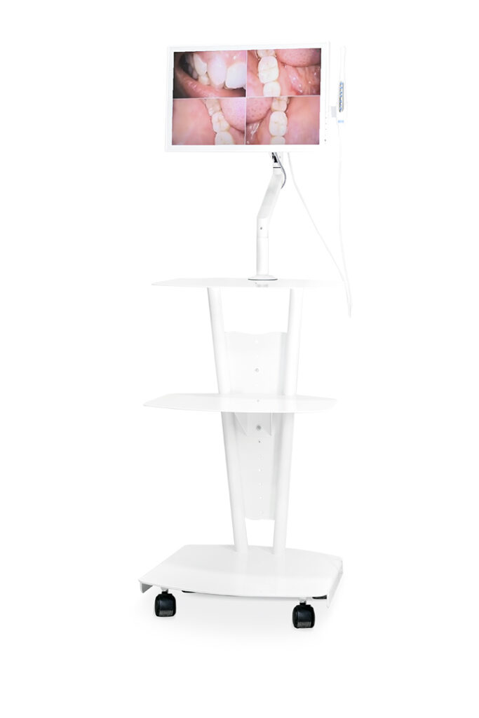Carrello SOFT con monitor 19 pollici e telecamera intraorale DETECT per diagnosi odontoiatrica