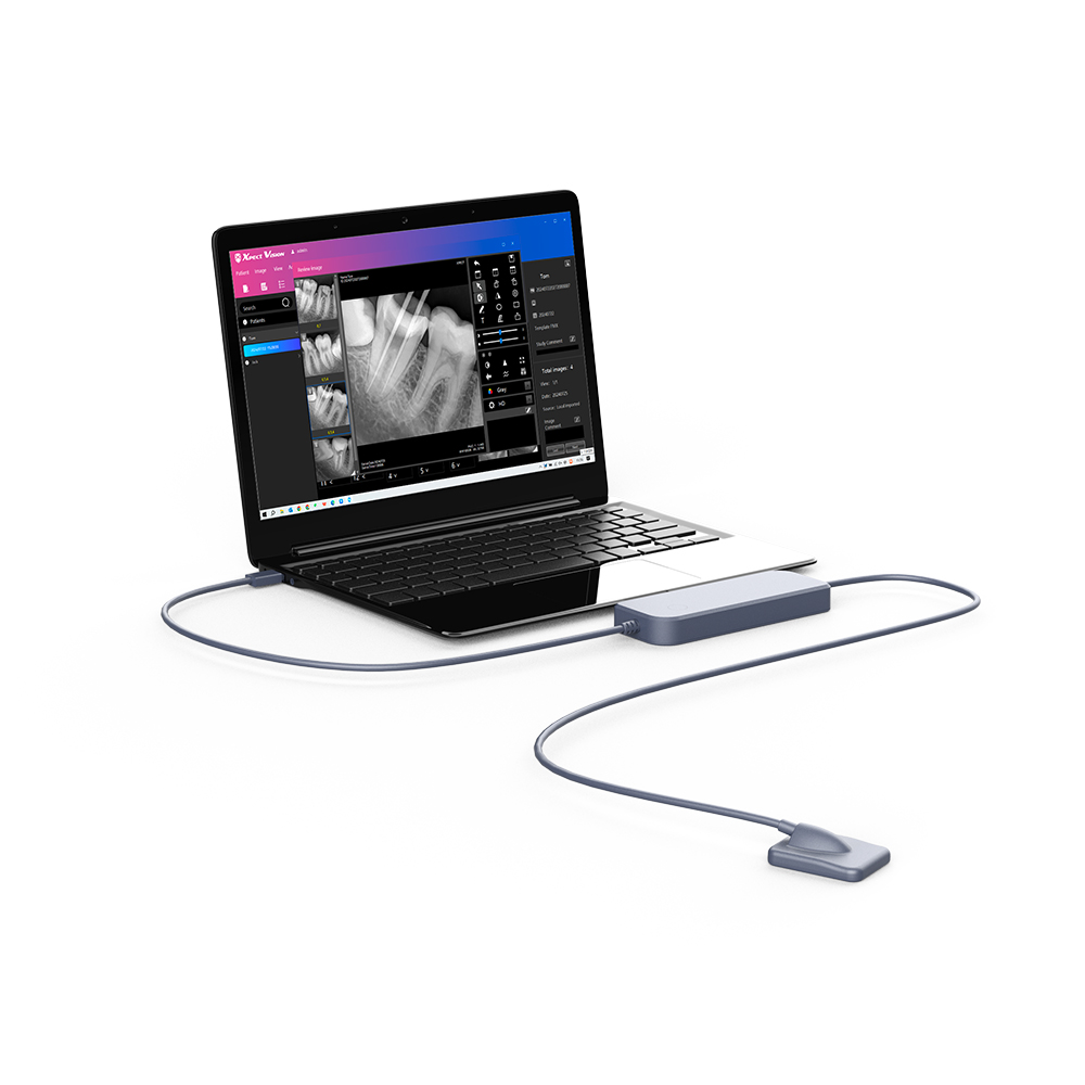 RVG19X dental sensor connected to a PC in a professional dental clinic
